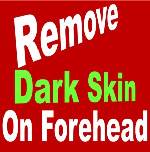 forehead dark skin