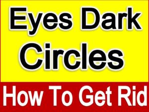 Eye Dark Circles 6 Amazing Beauty Tips