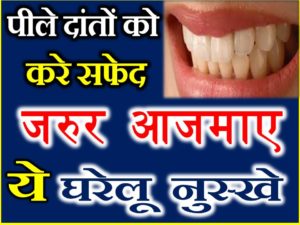 जानिए पीले दांतों को सफेद करने के घरेलू नुस्खे Yellow Teeth Home Remedies 