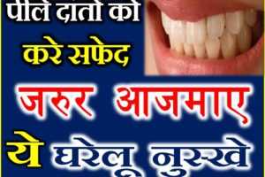 जानिए पीले दांतों को सफेद करने के घरेलू नुस्खे Yellow Teeth Home Remedies