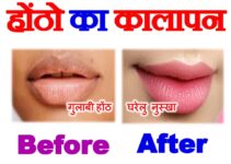होंठो का कालापन कैसे दूर करे How to Lighten Dark Lips
