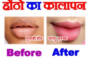 होंठो का कालापन कैसे दूर करे How to Lighten Dark Lips